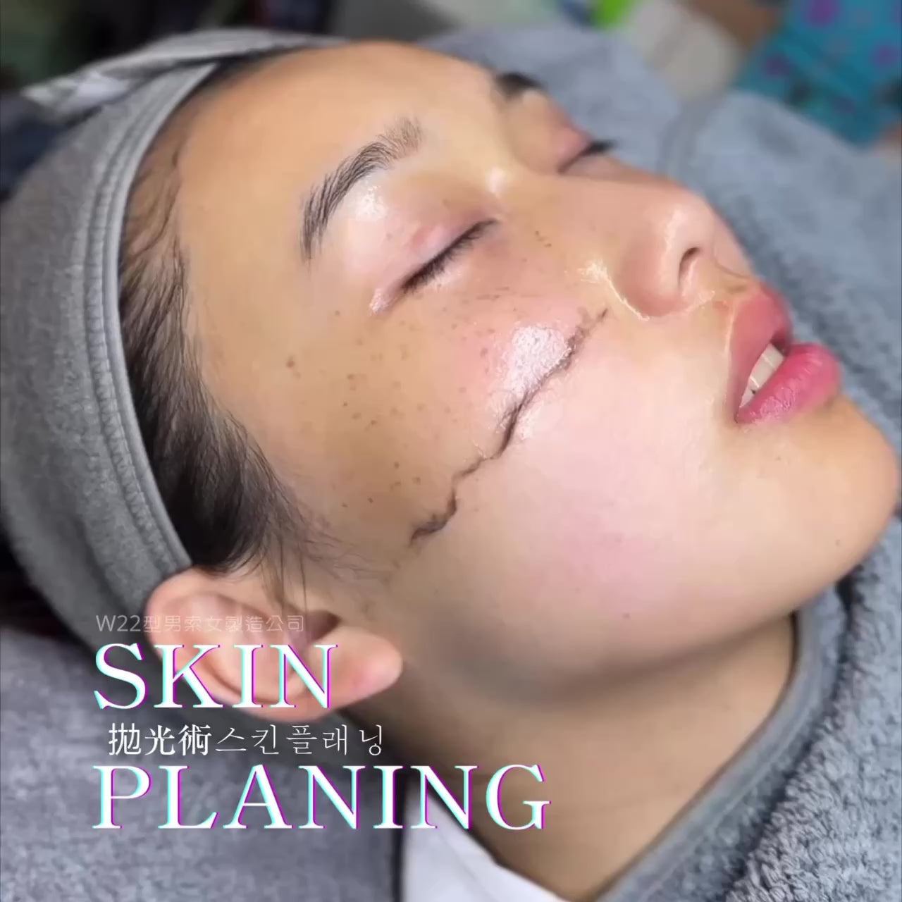 韓國Skinplaning拋光術